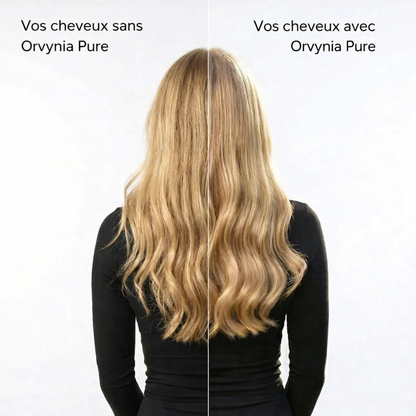 Pommeau Filtrant Orvynia PureSkin™