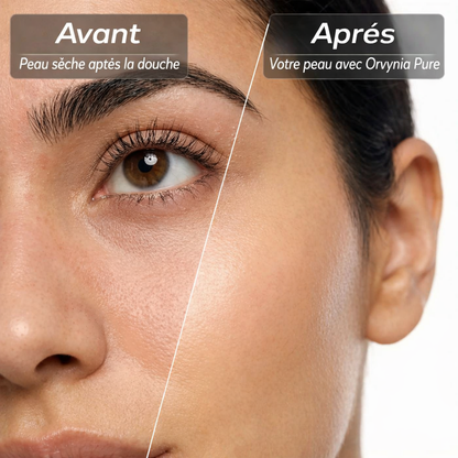Pommeau Filtrant Orvynia PureSkin™